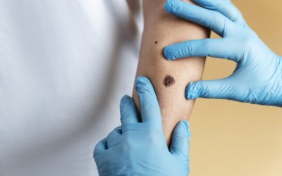 O aluniță fatală: O femeie a murit după o intervenție, detaliile șochează