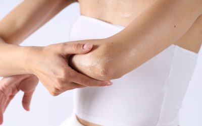 Piele uscată pe brațe și picioare? 5 obiceiuri care o înrăutățesc