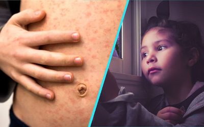 Rujeolă, gripă și refuzul vaccinării: Drama copiilor în România