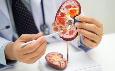 Acid uric și creatinină: Ce dezvăluie analizele despre sănătatea rinichilor