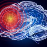 O tulburare neurologică, necunoscută, a fost descoperită