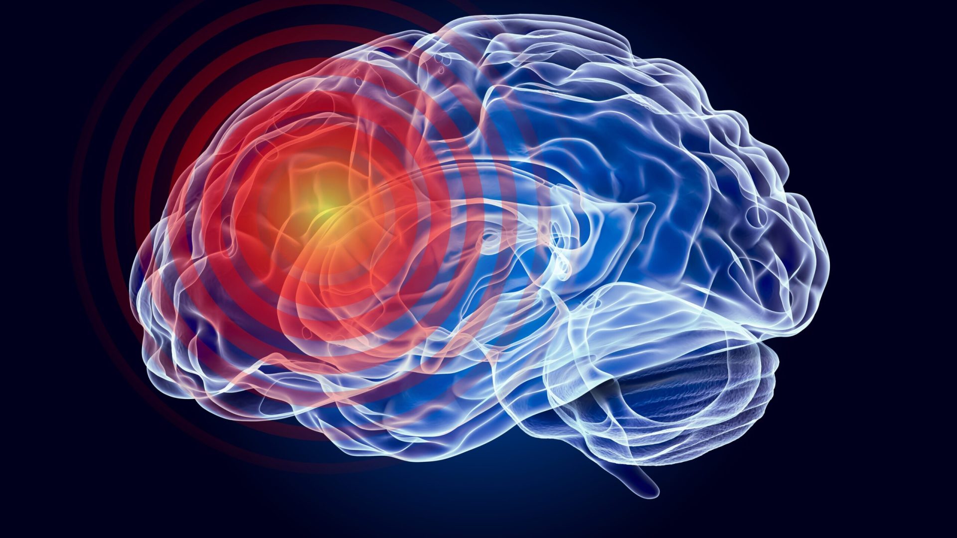 O tulburare neurologică, necunoscută, a fost descoperită