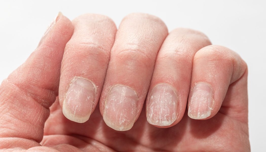 unghii.jpg - JurnalUrban