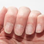 unghii.jpg - JurnalUrban