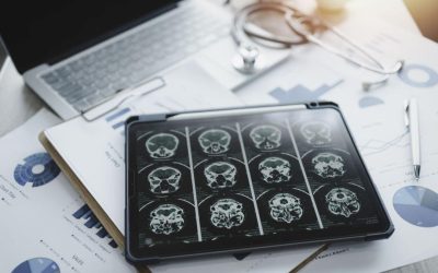 Traumatisme cranio-cerebrale: Pericol ascuns ani de zile