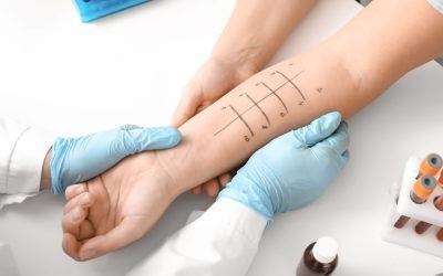 Intoleranță alimentară: Semnele, când alergi la medic