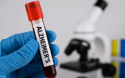 Alzheimer, prin sânge: Boală infecțioasă? Studiu șocant