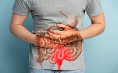 Simptom ignorat 10 ani: Cancer de colon, stadiul IV