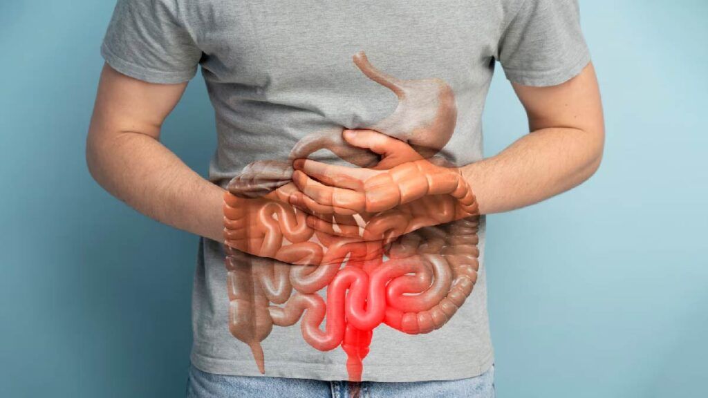 Simptom ignorat 10 ani: Cancer de colon, stadiul IV