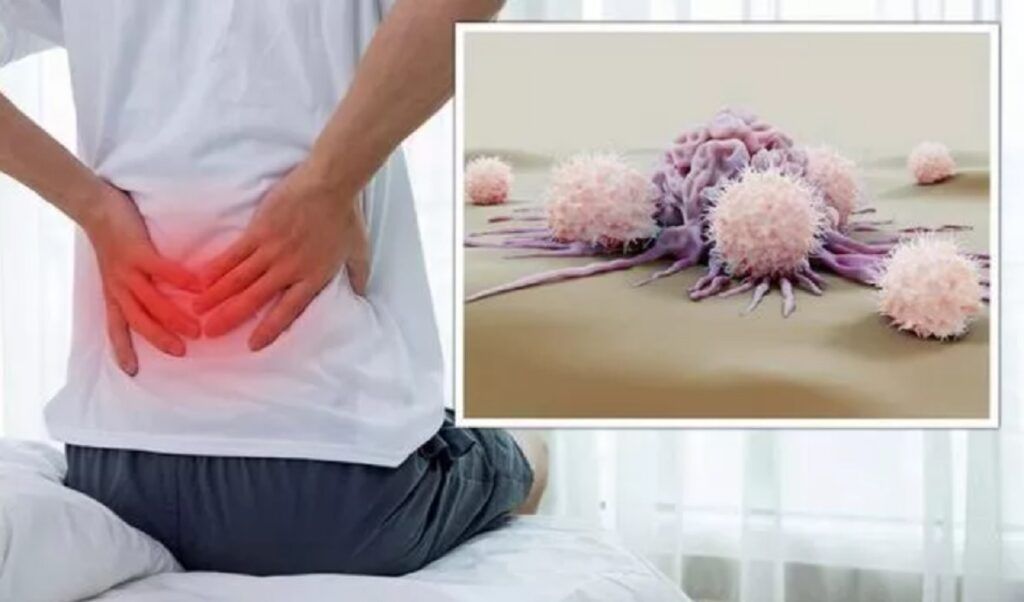 Cancerul „tăcut”: 5 simptome uitate de medici