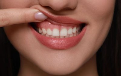 Alunița din gură: Risc ascuns pentru sănătate