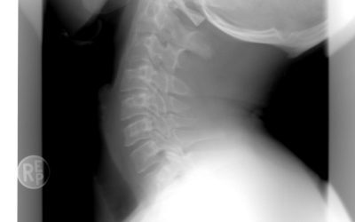 Bihor: AI ajută radiologii de la Urgențe să citească imagini