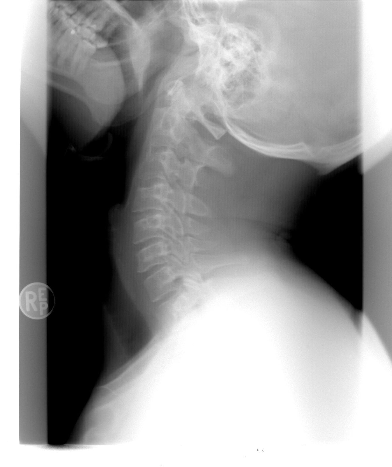 Bihor: AI ajută radiologii de la Urgențe să citească imagini