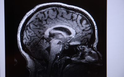 Creierul: Unde oxitocina învinge frica, descoperire majoră