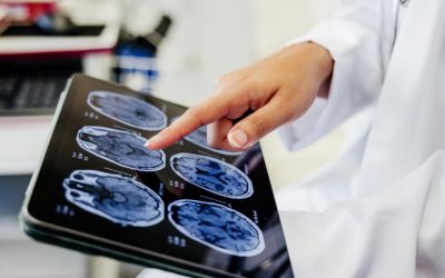 IA în premieră: Neurochirurgii din Londra au operat creierul cu ajutorul inteligenței artificiale
