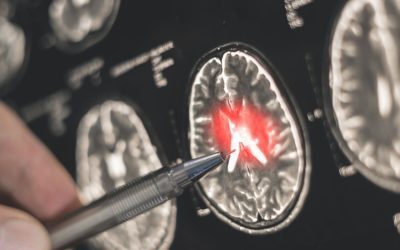 Creierul: Frica și iubirea se ciocnesc în aceeași zonă