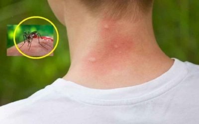 Țânțarii te aleg! 3 bacterii cheie, descoperite