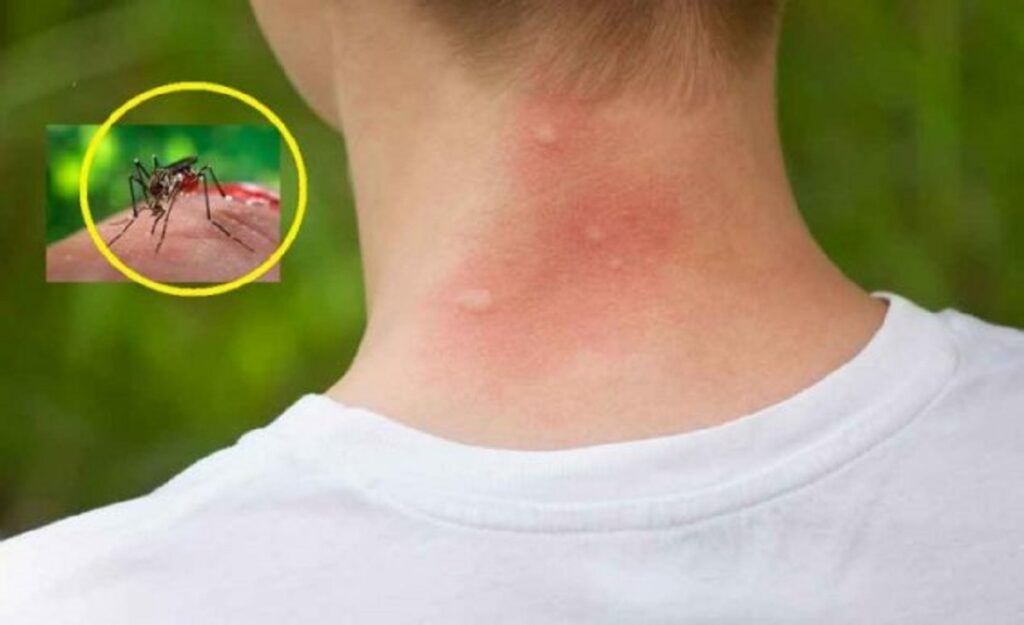 Țânțarii te aleg! 3 bacterii cheie, descoperite