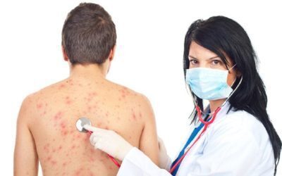 Zoster: Vaccinul ce-ar putea proteja și creierul