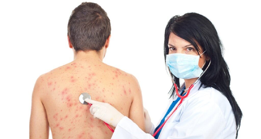 Zoster: Vaccinul ce-ar putea proteja și creierul