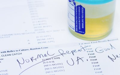Test Urină: Depistează 9 din 10 Câncer Vezică