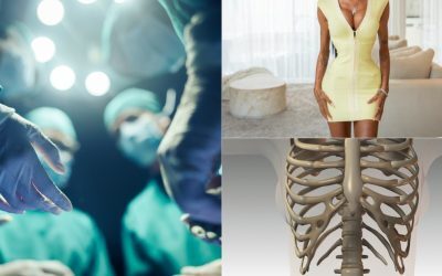 Șoc: Femei își rup coastele pentru talie, medicii avertizează